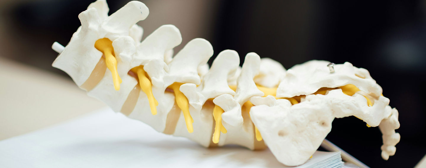 Spinal model used for patient education
