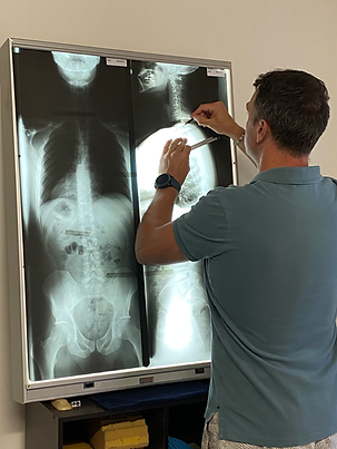 Practitioner reviewing spinal x-rays
